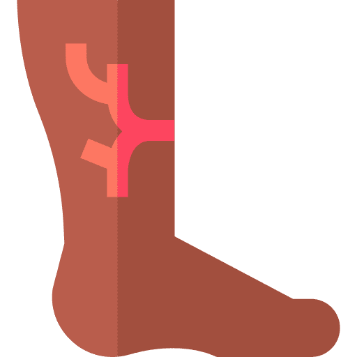 tratamiento de escleroterapia